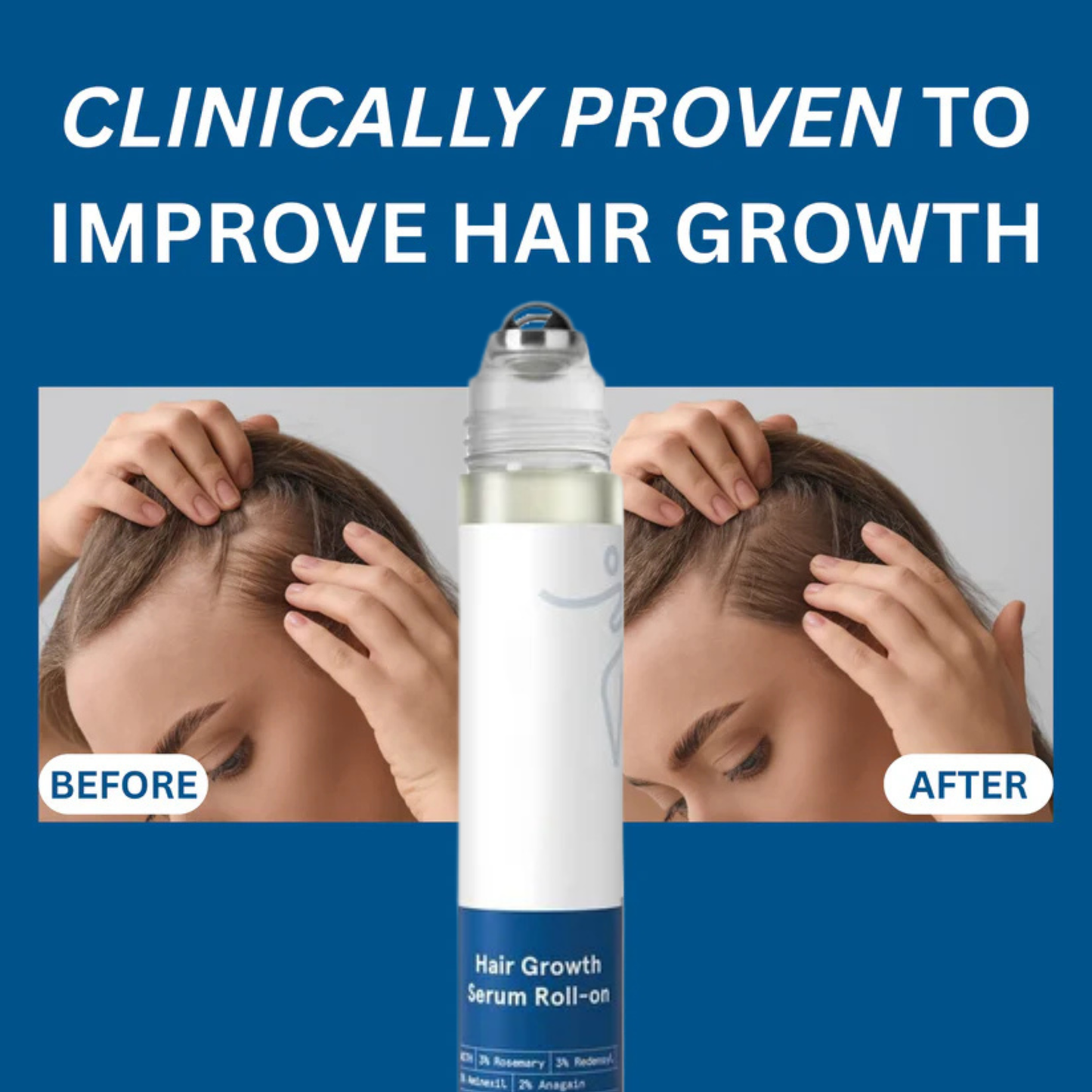 Tressera™ Root Revival Roll-On Serum