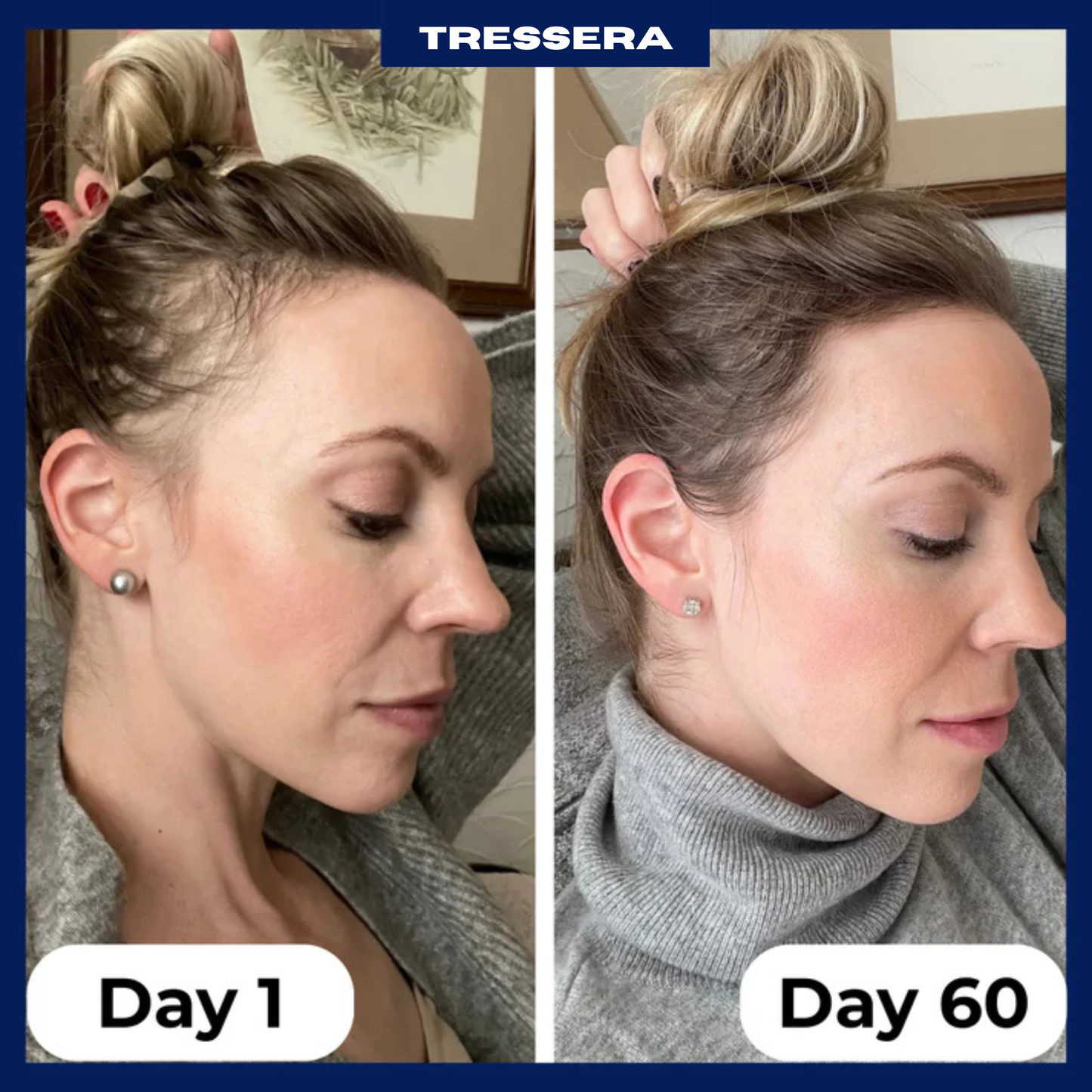 Tressera™ Root Revival Roll-On Serum