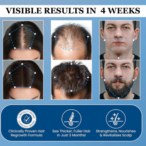 Tressera™ Root Revival Roll-On Serum