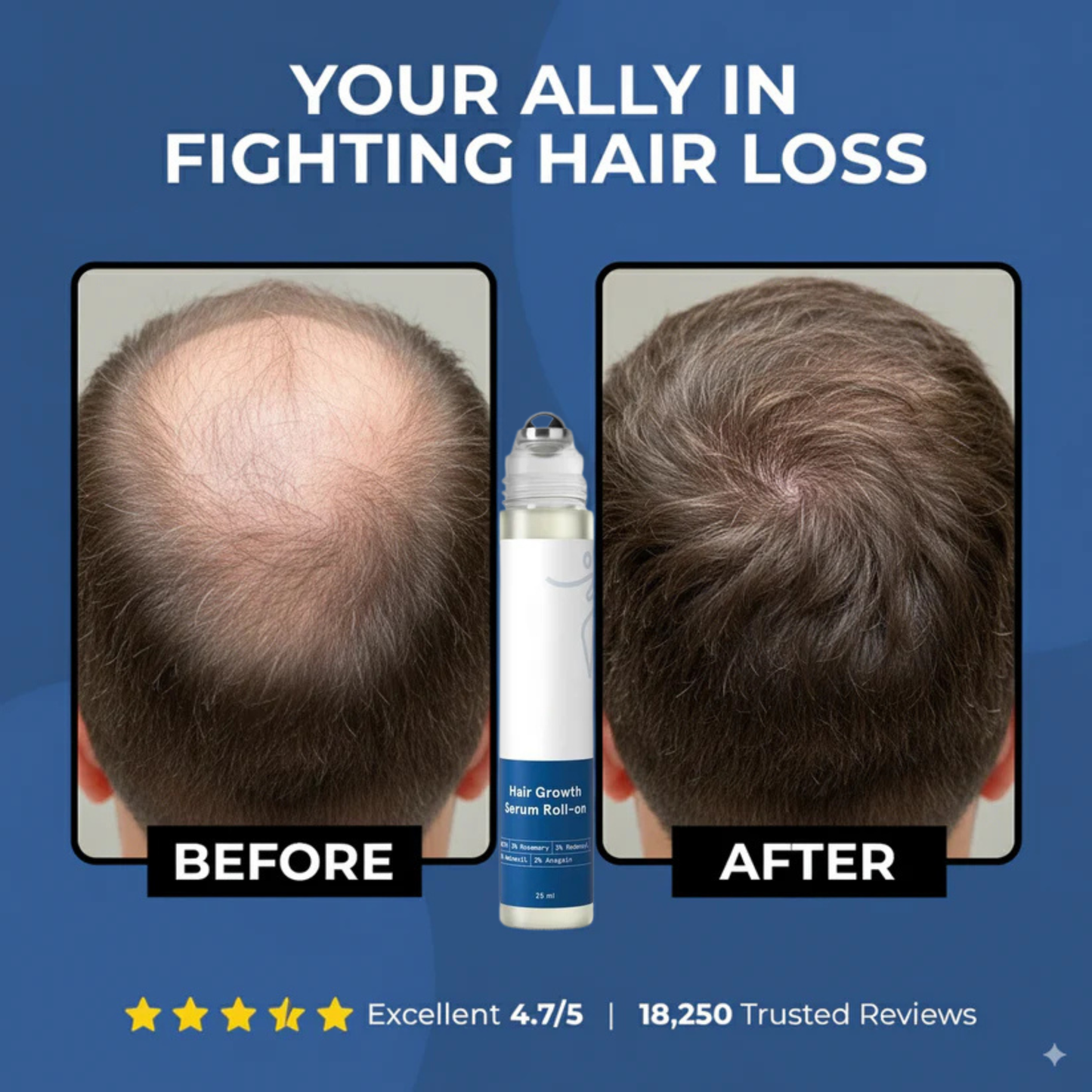 Tressera™ Root Revival Roll-On Serum