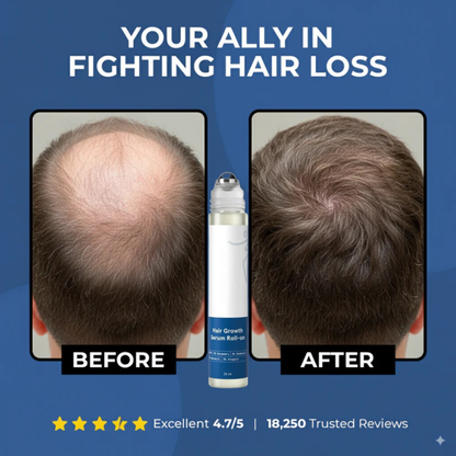 Tressera™ Root Revival Roll-On Serum